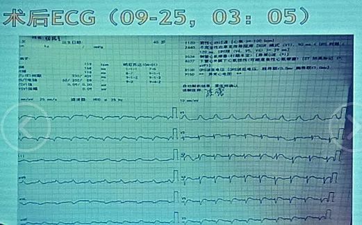 亚洲综合内射少妇AV 未来可能会有更多创新形式
