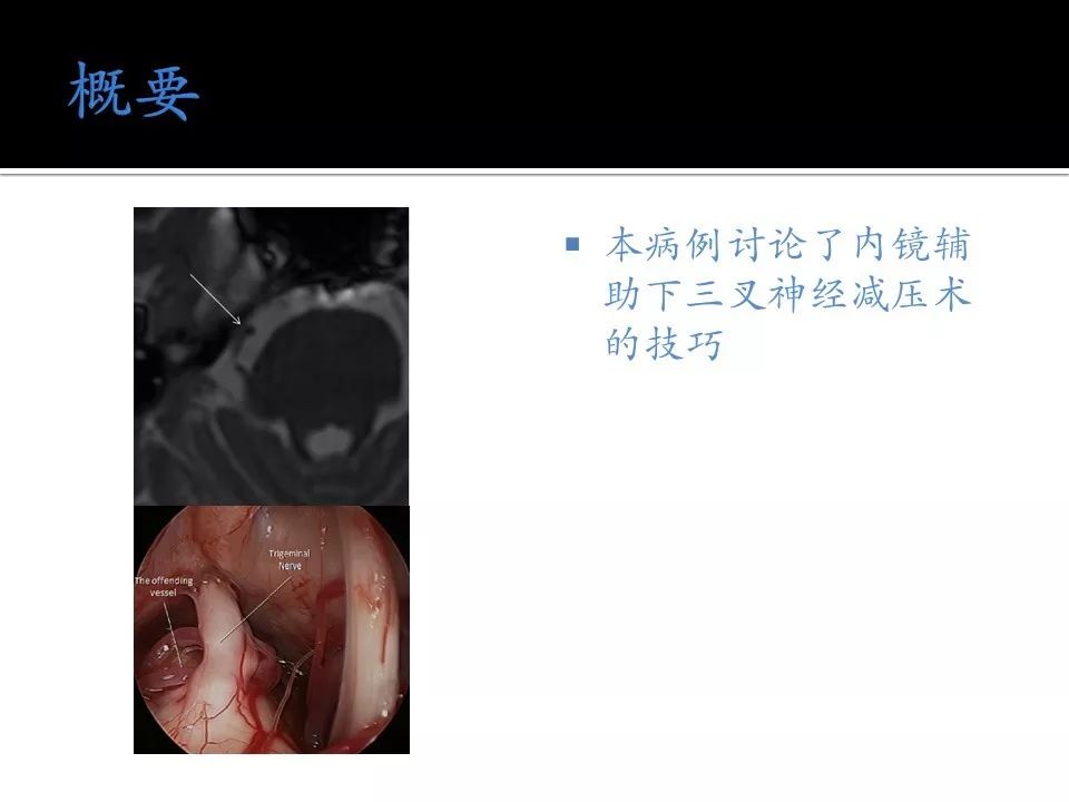 国产乱码卡1卡二卡3卡四卡