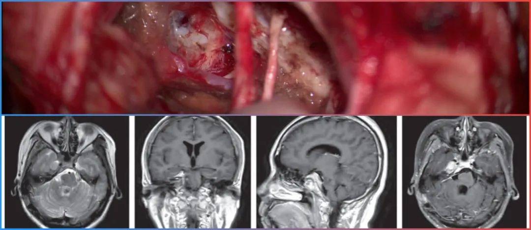 暗網 幼女 我还没有学会回答这个问题