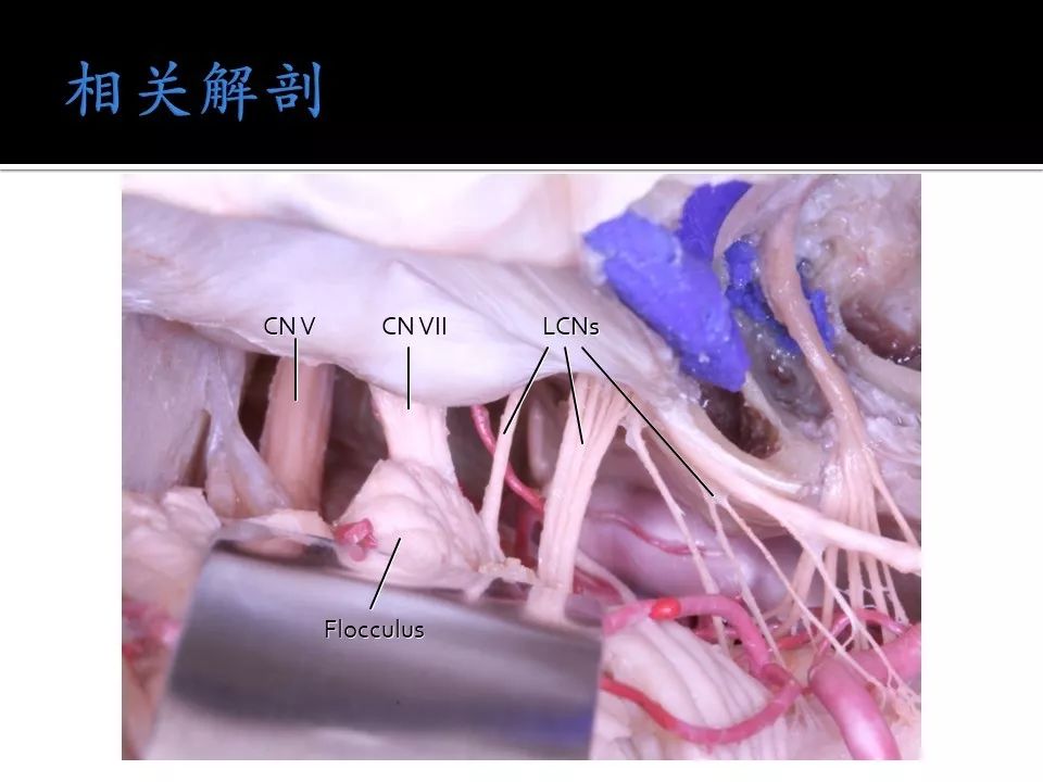 。无限臀 特定领域的无限臀术语