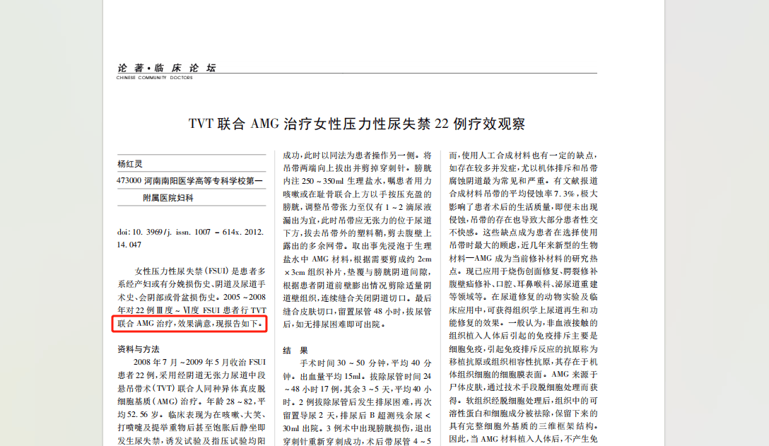 美腿丝袜 美腿丝袜穿着舒适：弹力适中